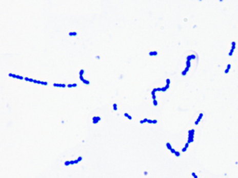 Streptococcus pyogenes цветной рисунок. S. pyogenes малюнок. Pyogenes Streptococcus сыпь на лице.